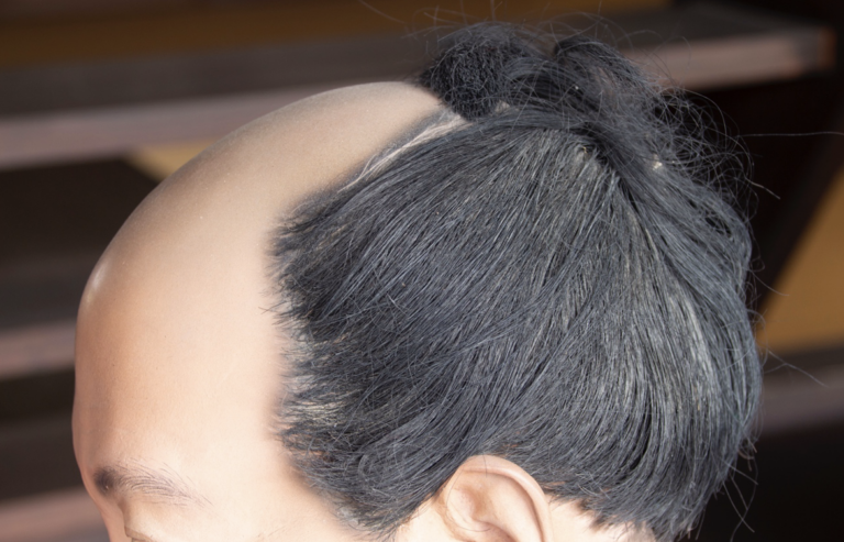 Qu’est-ce que le légendaire « chonmage » ? Une coiffure réalisée dans le sang